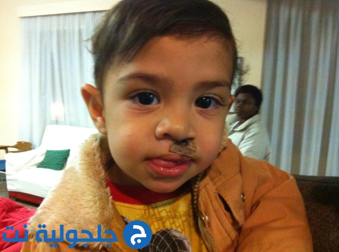فؤاد عودة: 10 أطفال من العراق خضعوا للجراحة  بمستشفيات ايطاليا